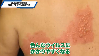 撃った人も撃たなかった人もワ◯◯◯解毒・健康知識、井上正康先生のお話=ダニエル社長のチャンネル、消される前に見てみよう! 撃った人も撃たなかった人もワ◯◯◯解毒・健康知識、井上正康先生のお話=ダニエル社長のチャンネル、消される前に見てみよう!