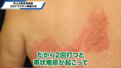 撃った人も撃たなかった人もワ◯◯◯解毒・健康知識、井上正康先生のお話=ダニエル社長のチャンネル、消される前に見てみよう! 撃った人も撃たなかった人もワ◯◯◯解毒・健康知識、井上正康先生のお話=ダニエル社長のチャンネル、消される前に見てみよう!