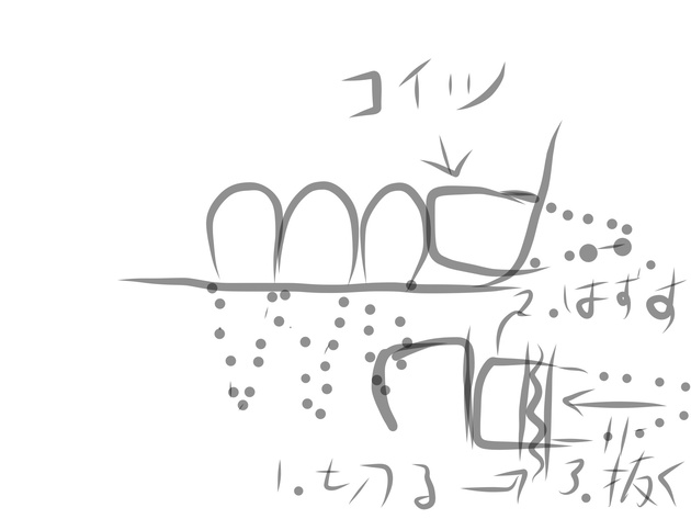 昨日、歯、親知らずの手術に行って参りました。歯や歯医者について考 昨日、歯、親知らずの手術に行って参りました。歯や歯医者について考