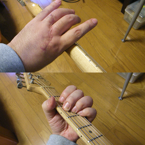 ギターでリハビリ