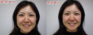 小顔矯正・頭蓋骨矯正 小顔矯正・頭蓋骨矯正
