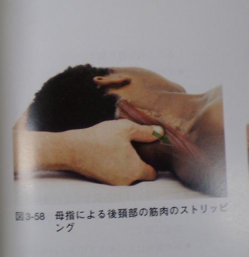 慢性頭痛の解消法! 慢性頭痛の解消法!